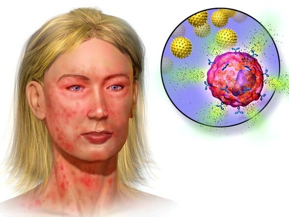 echinokoky a příznaky jejich přítomnosti v těle